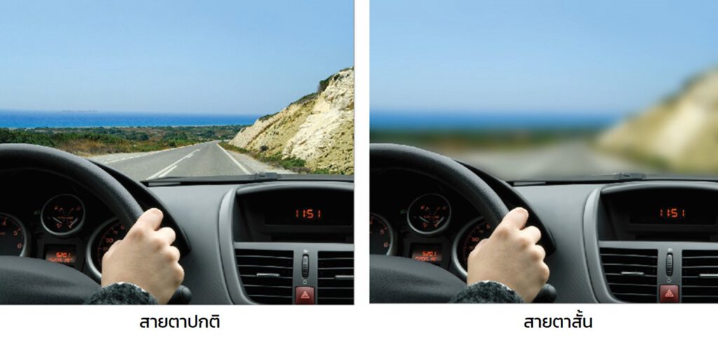 สายตาสั้นมาก เลือกใช้เลนส์อย่างไรดี